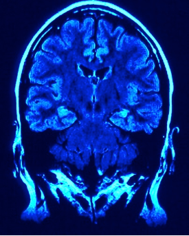 MRI of human head